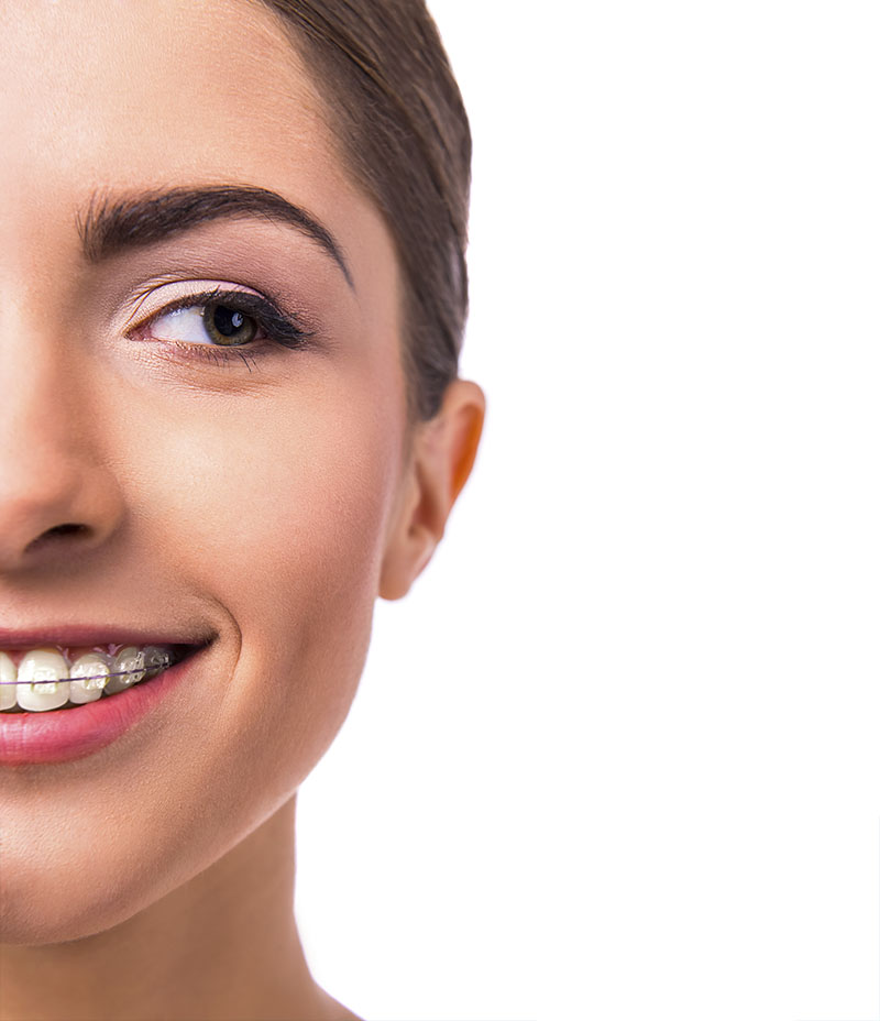 Ortodoncia en IMED Dental