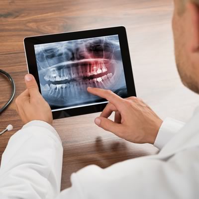 diagnóstico dental en 3D