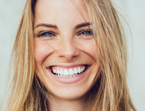 Estetiske problemer som hindrer oss i å ha det “perfekte smilet”