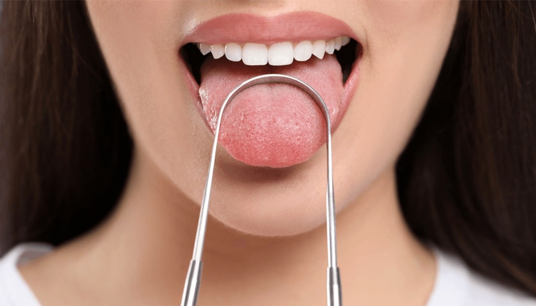 Mal olor de boca · Prueba estos remedios caseros - IMED Dental
