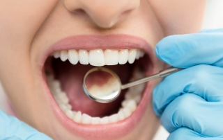 causas-de-la-hipoplasia-dental