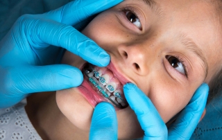 Que es la ortodoncia infantil, o ortodoncia en niños