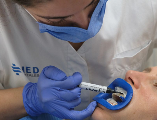Sonrisa y dientes blancos con el blanqueamiento dental de última generación de Philips