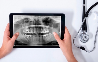 CBCT