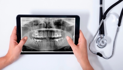 CBCT