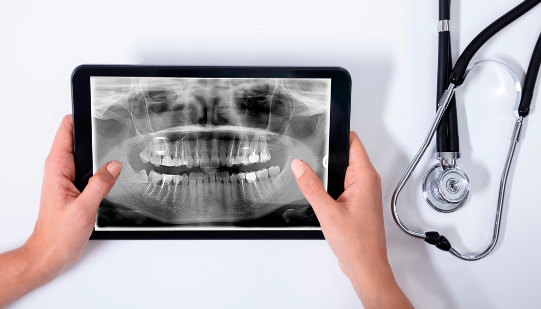 CBCT