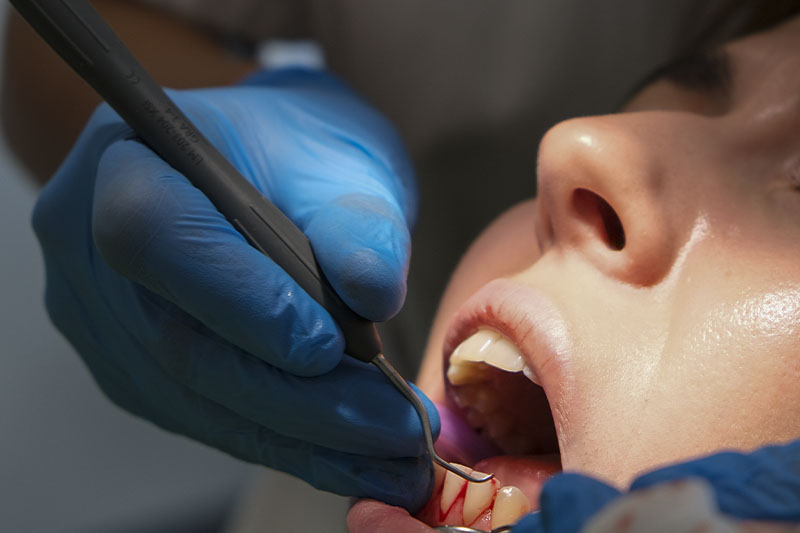 Periodoncia-IMED