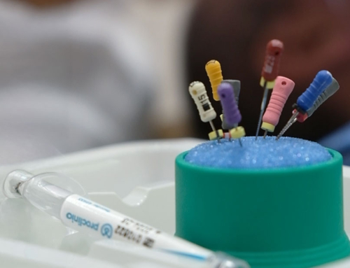 ¿Cuándo es necesaria una endodoncia? Síntomas que no debes ignorar